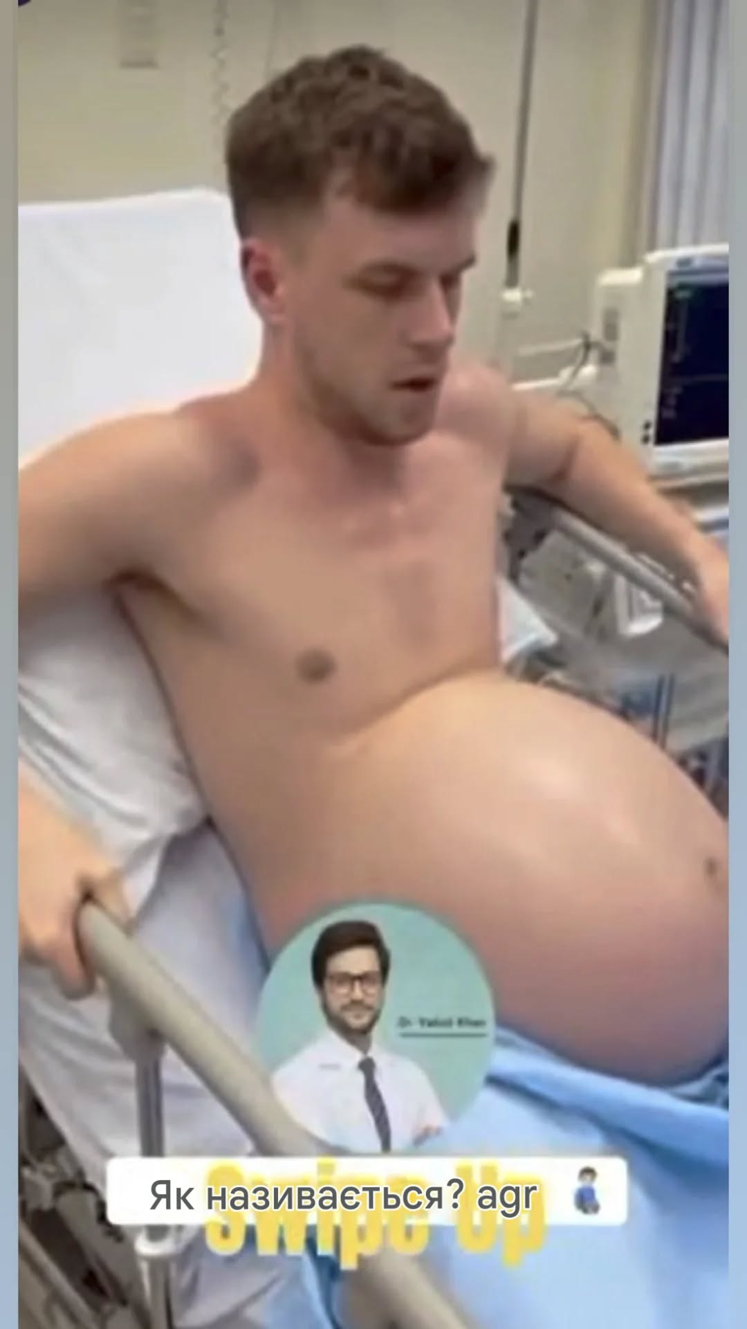 Чоловік відрізав частину носа, зробив татуювання та вставив імпланти, щоб виглядати як супергерой: ось як він виглядав раніше